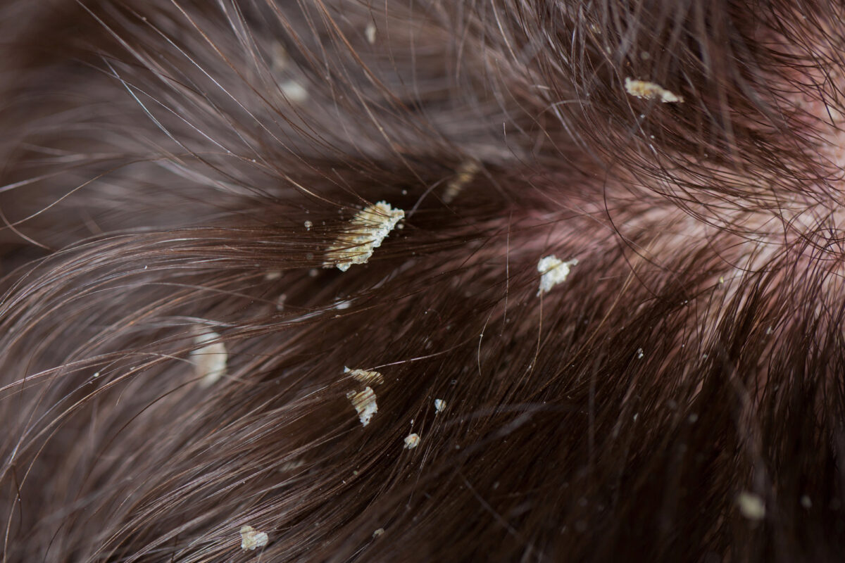 Depositphotos 101785464 L 1 e1749687780531