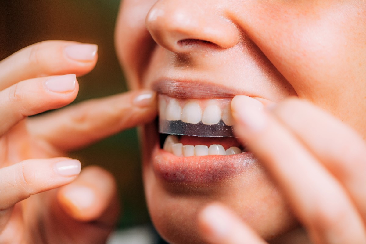 Teeth whitening